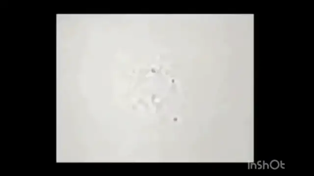 CANCER IS CAUSED BY PARASITES VIDEO PROOF