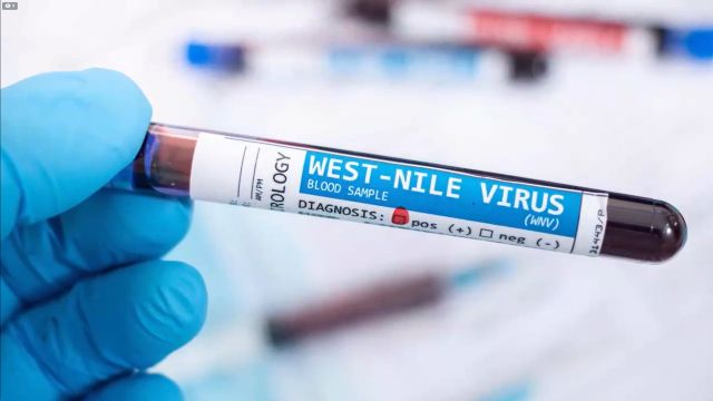 Dr Faucis West Nile Virus - Dr Sam Bailey