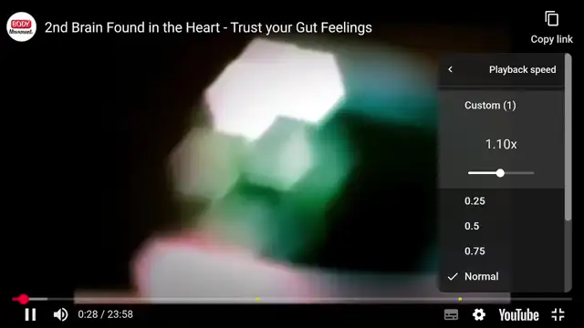 30% of Organ Donors Still Alive