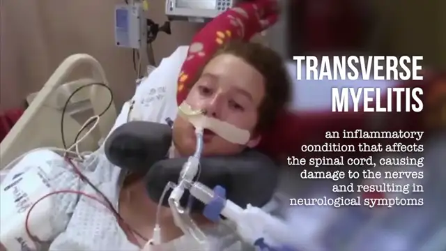 An Inconvenient Study